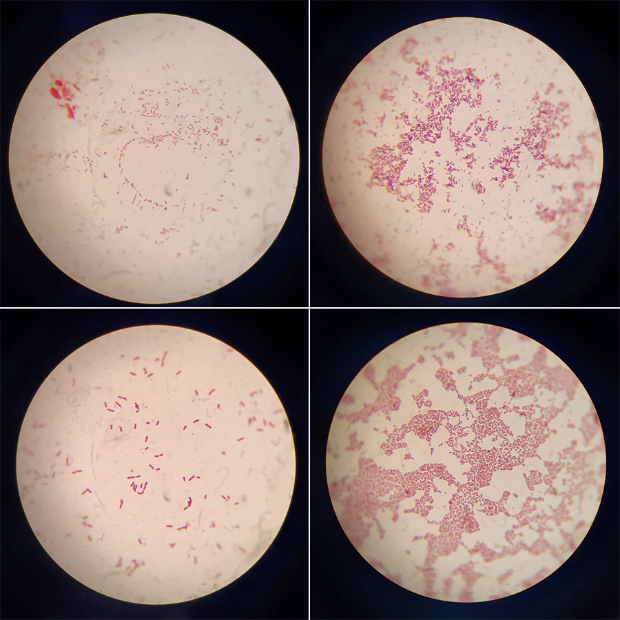 Images of bacterial cultivations from the rhizosphere of ghaf trees (Prosopis cineraria). 